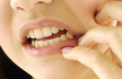 突發(fā)性、自發(fā)性的劇烈牙疼