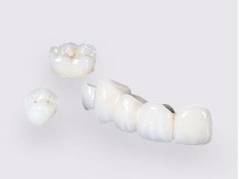 承德烤瓷牙選多少錢(qián)一顆的合適