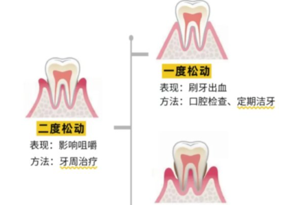 老年人牙齒松動了要怎么辦？