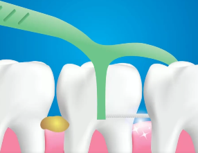 口腔問題可能要“命”！5大預警信號，別忽視