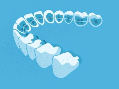 惟德口腔醫(yī)院口腔正畸好不好？