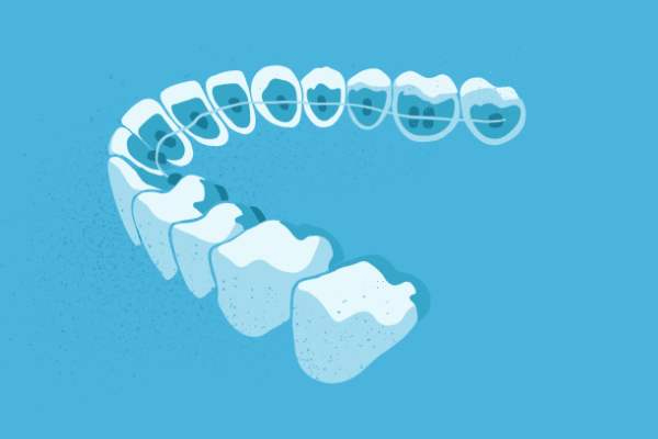 惟德口腔醫(yī)院口腔正畸好不好？